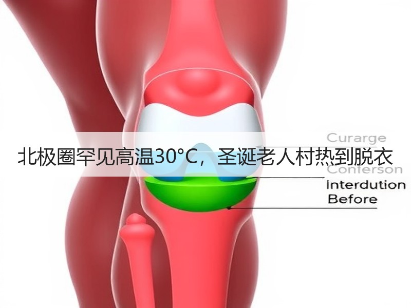 北极圈罕见高温30°C，圣诞老人村热到脱衣