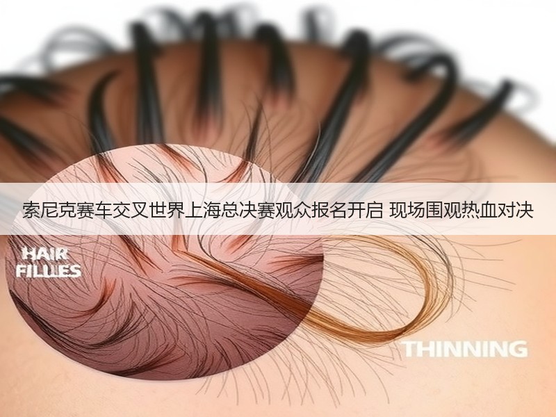 索尼克赛车交叉世界上海总决赛观众报名开启 现场围观热血对决