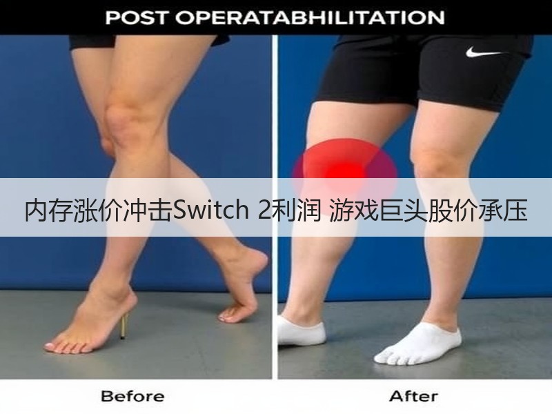 内存涨价冲击Switch 2利润 游戏巨头股价承压