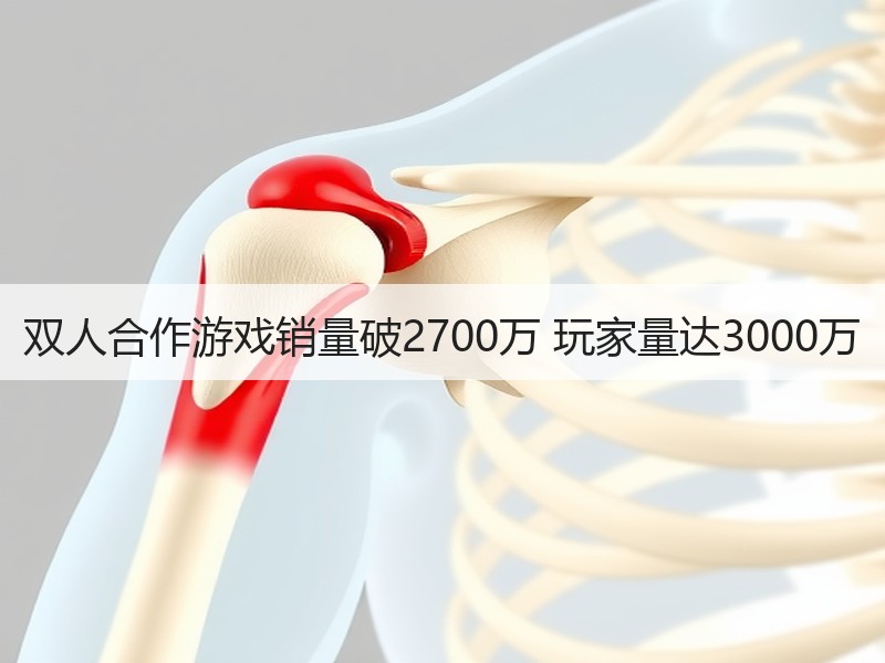 双人合作游戏销量破2700万 玩家量达3000万